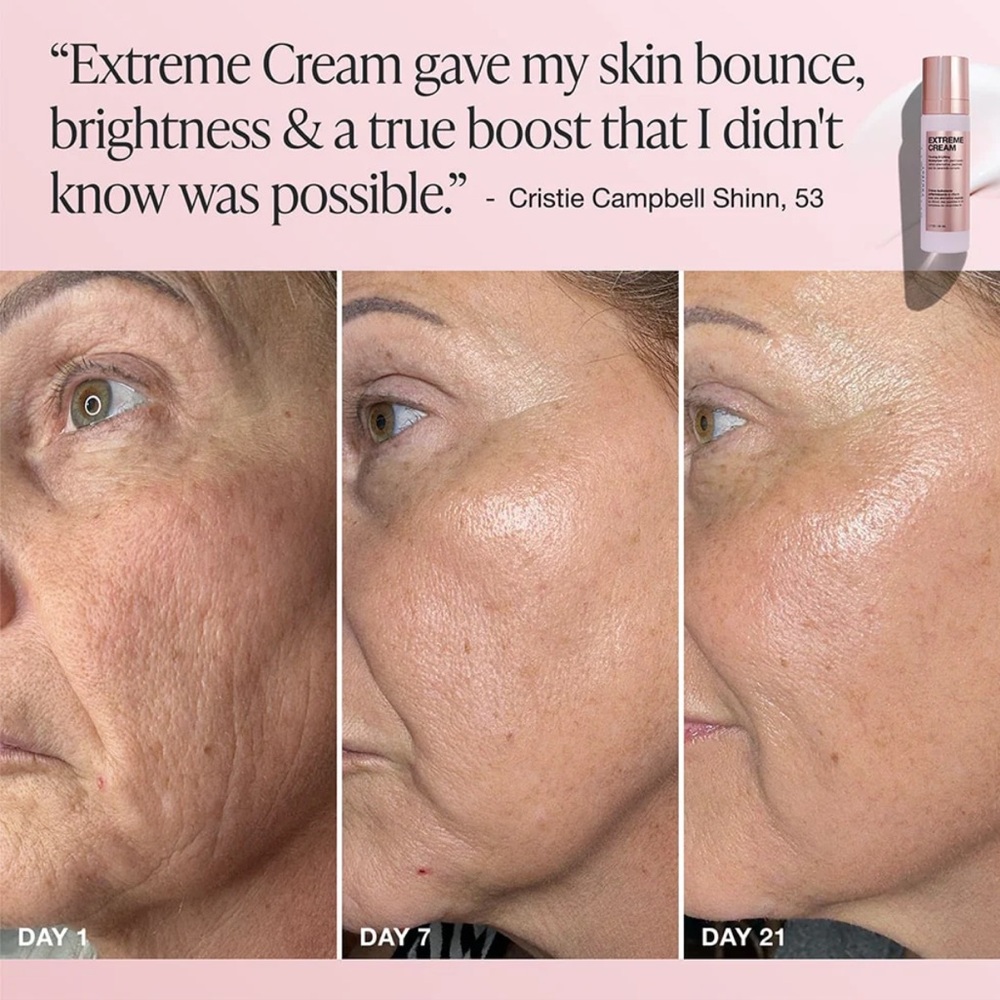 INNBeauty Extreme Cream Firming & Lifting - Picture 4 of 11